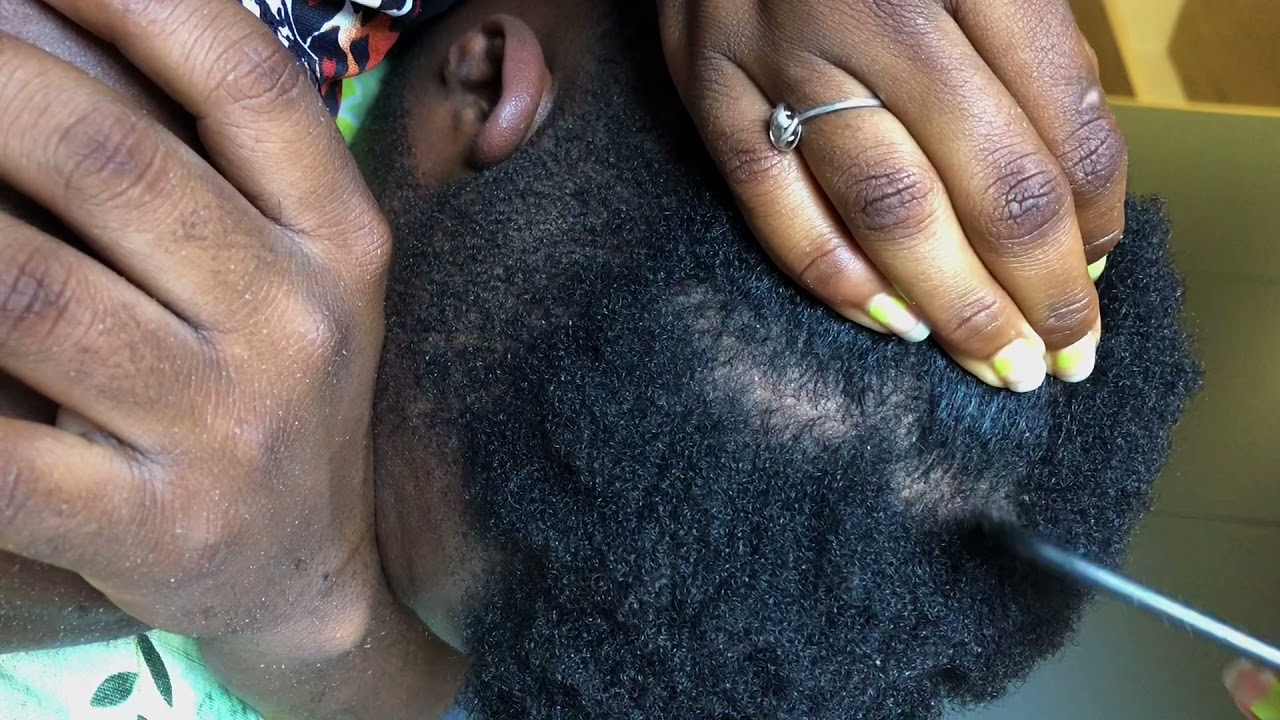 ASMR| Fast Scalp Scratch & Head Massage
