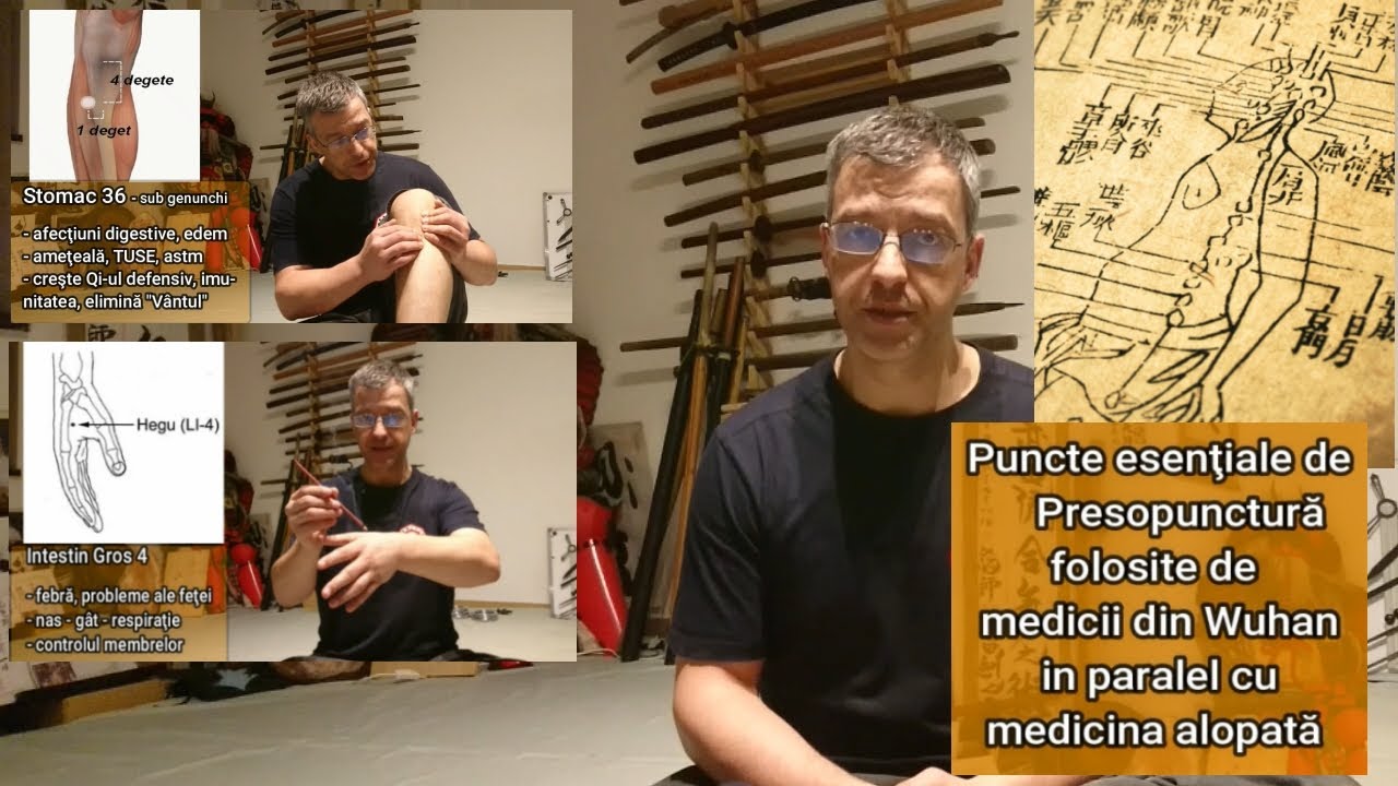 Presopunctura - Puncte folosite de medicii din Wuhan ca anexa la terapia moderna a Covid19