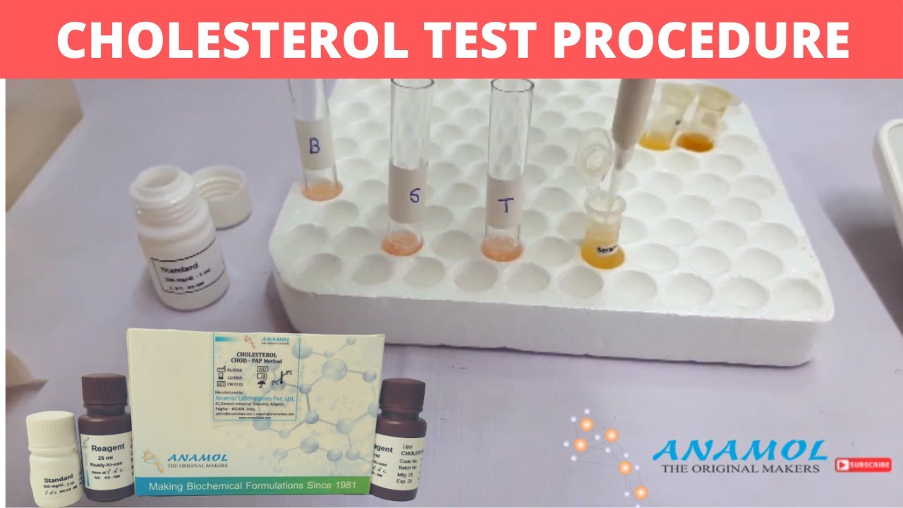 CHOLESTEROL Test Procedure | CHOLESTEROL Reagent | Procedure for performing CHOLESTEROL Reagent Test