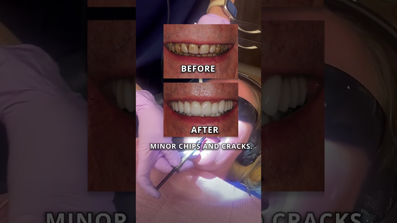 One Way to Refresh Your Smile
