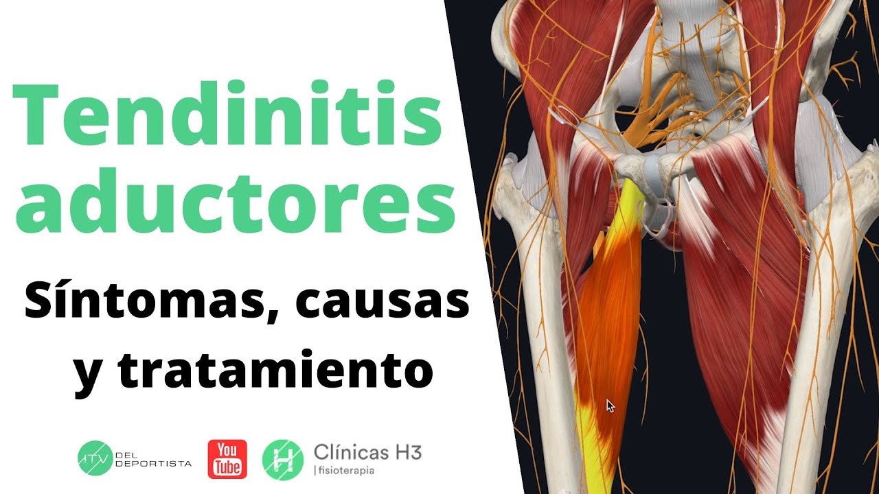 Tendinitis en aductores ✅ Causas y tratamiento con fisioterapia | Clínicas H3