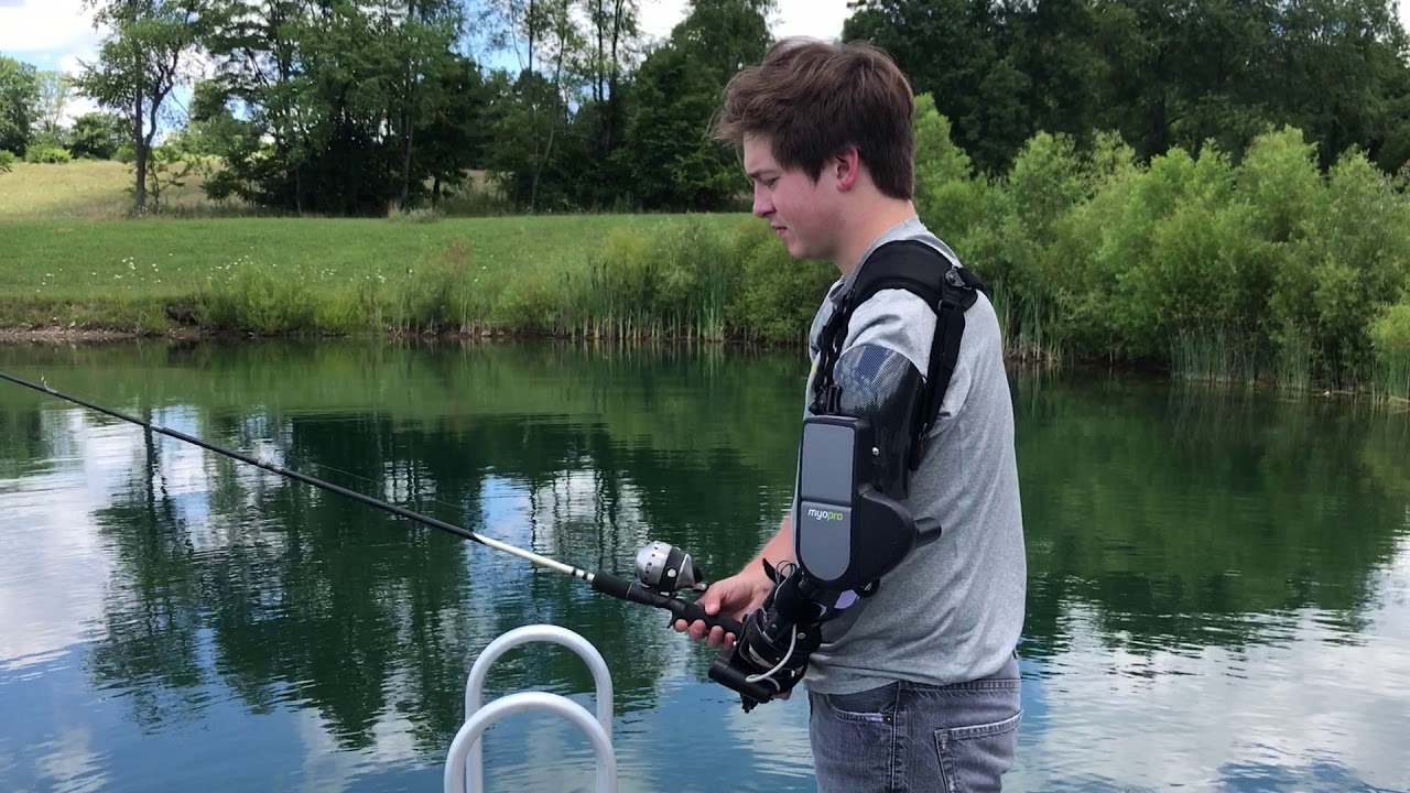 Teen regains use of arm through MyoPro 2 robotic device