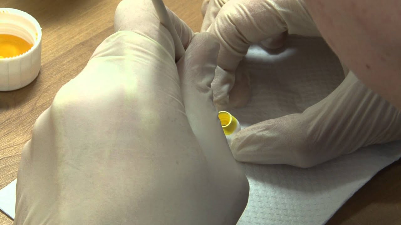 How to Make a Zirconia Crown