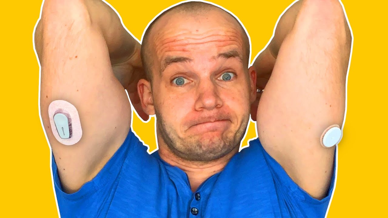 FreeStyle Libre 2 vs Dexcom G6 | Full Review & My Experience