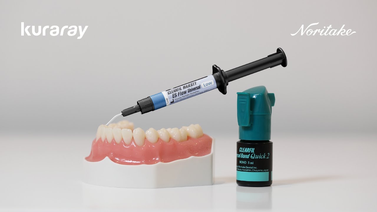 Direct restoration workflow | CLEARFIL Universal Bond Quick 2 + ES Flow Universal (Low)