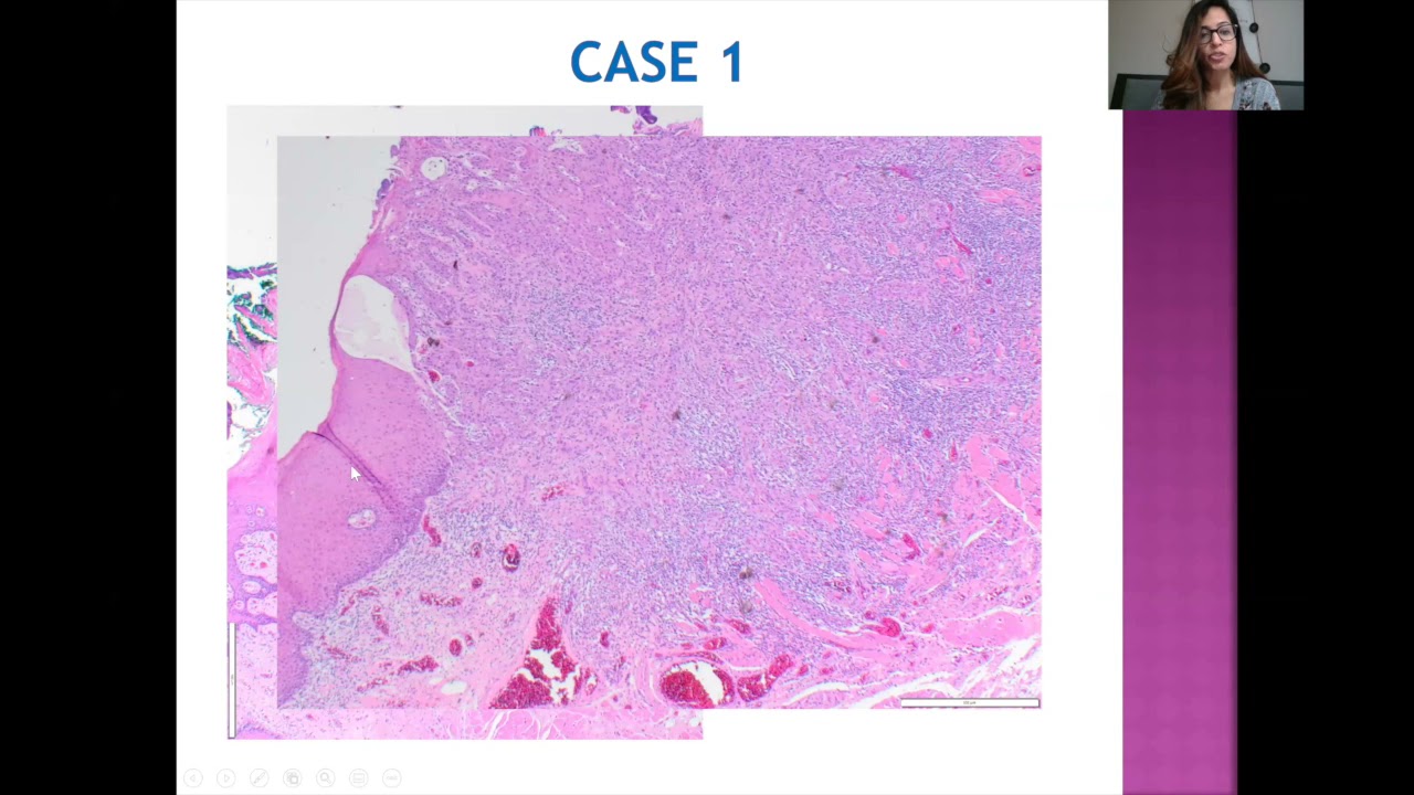 LG PathLab webinars:   Head &  Neck pathology : Case based discussions
