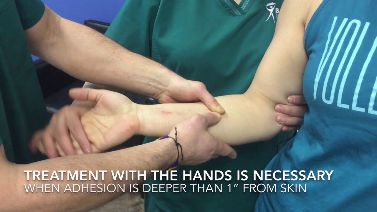 Got wrist pain? You may have ADHESION.