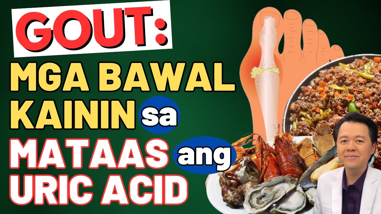 Gout: Mga Bawal Kainin sa Mataas ang Uric Acid. - By Doc Willie Ong
