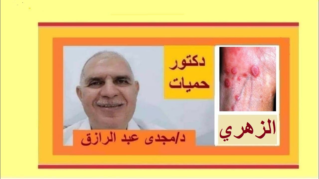 الزهري الأعراض والعلاج بودكاست