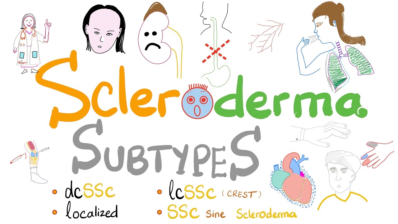 Scleroderma Subtypes (5 Types of Systemic Sclerosis incl. Limited vs Diffuse Scleroderma)