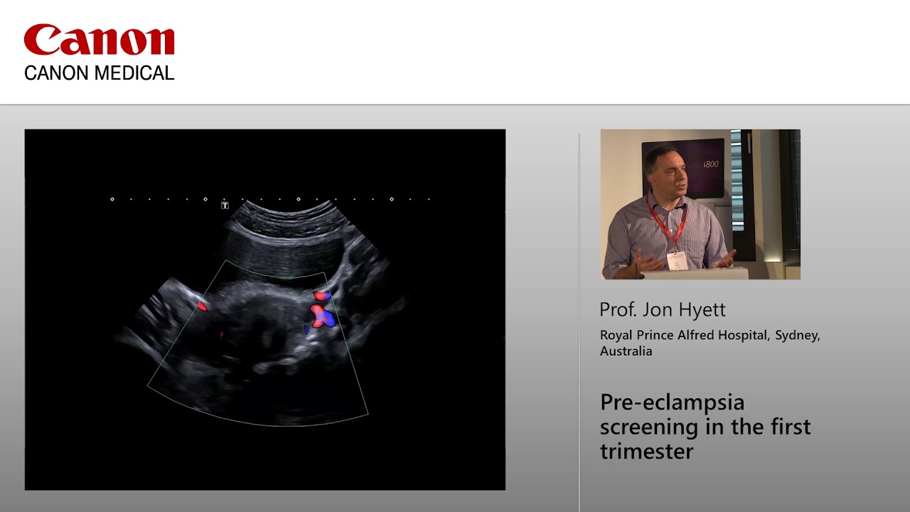 Professor Jon Hyett - Pre-eclampsia screening in the first trimester