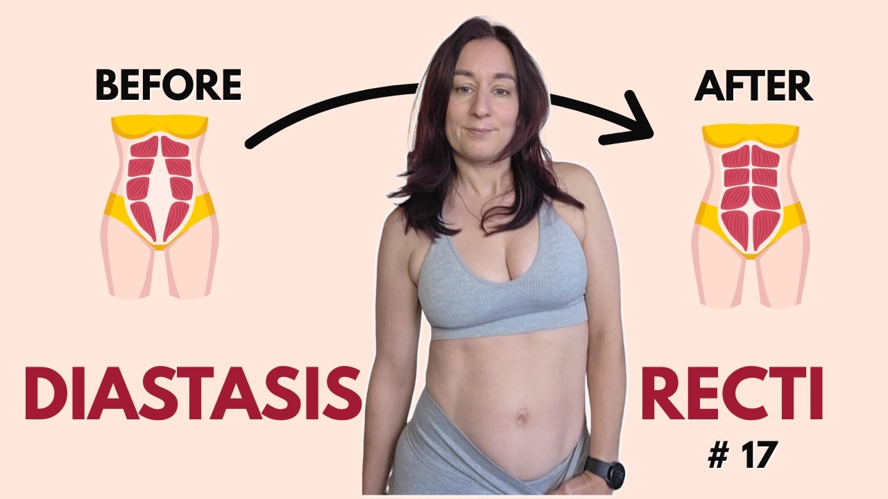 HEAL YOUR DIASTASIS RECTI POSTPARTUM CHALLENGE| Only 5 Minutes Daily