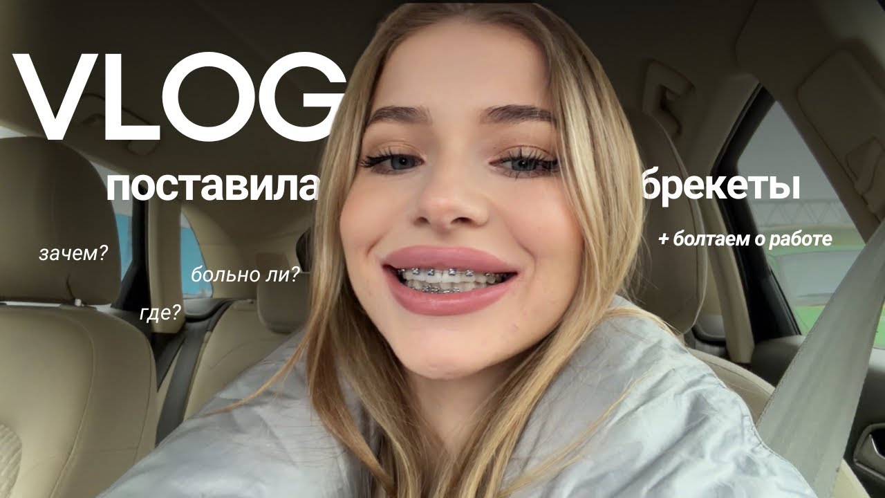VLOG | Я ПОСТАВИЛА БРЕКЕТЫ | зачем и почему, первые ощущения // день на работе 