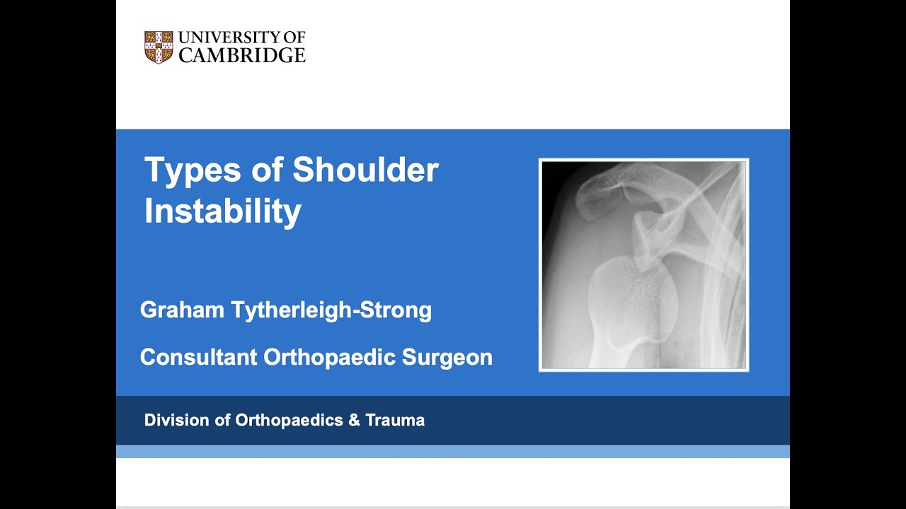 Types of Shoulder Instability