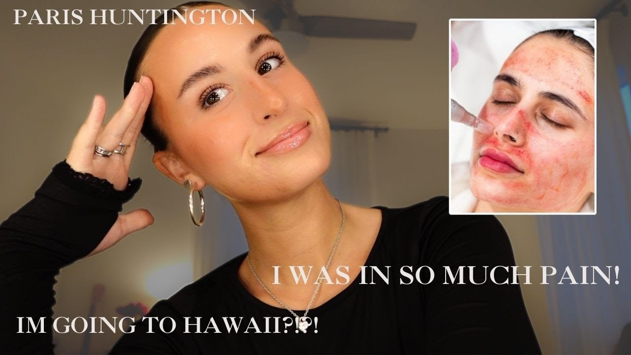 my horrifying microneedling experience - day in my life vlog