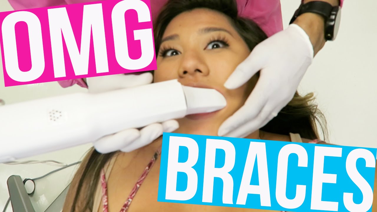 I'M GETTING BRACES