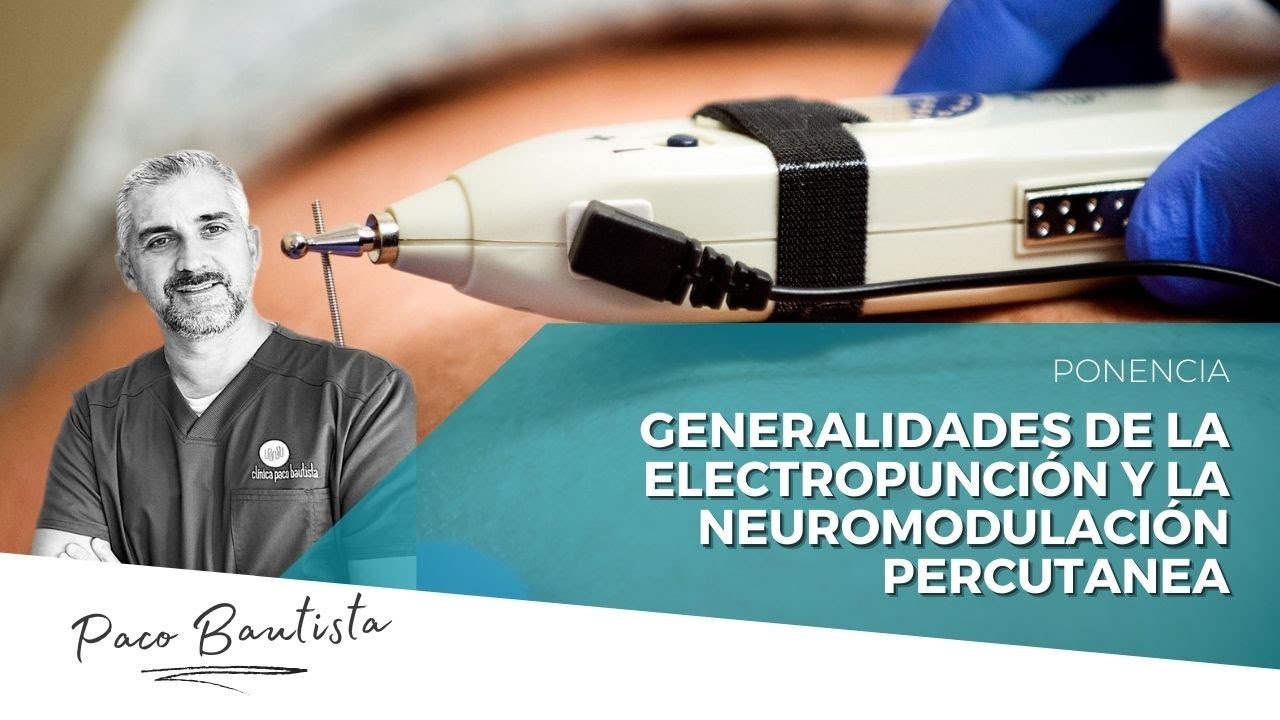 Generalidades de la Electropunción  y la Neuromodulación Percutanea
