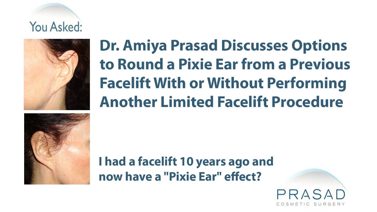 The Options to Correct a Pixie Ear from a Previous Facelift Performed a Decade Ago