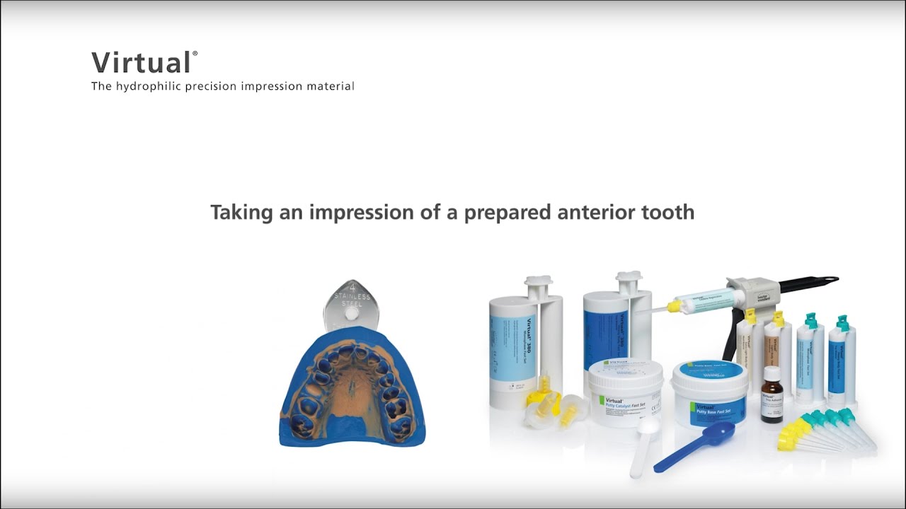 Virtual &ndash; Taking an impression of a prepared anterior tooth