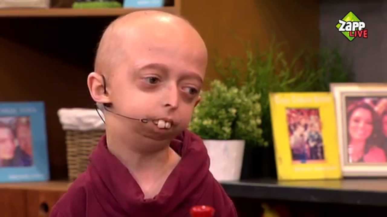 Bjorn over progeria en zijn bijzondere wens | Zapplive | NPO Zapp