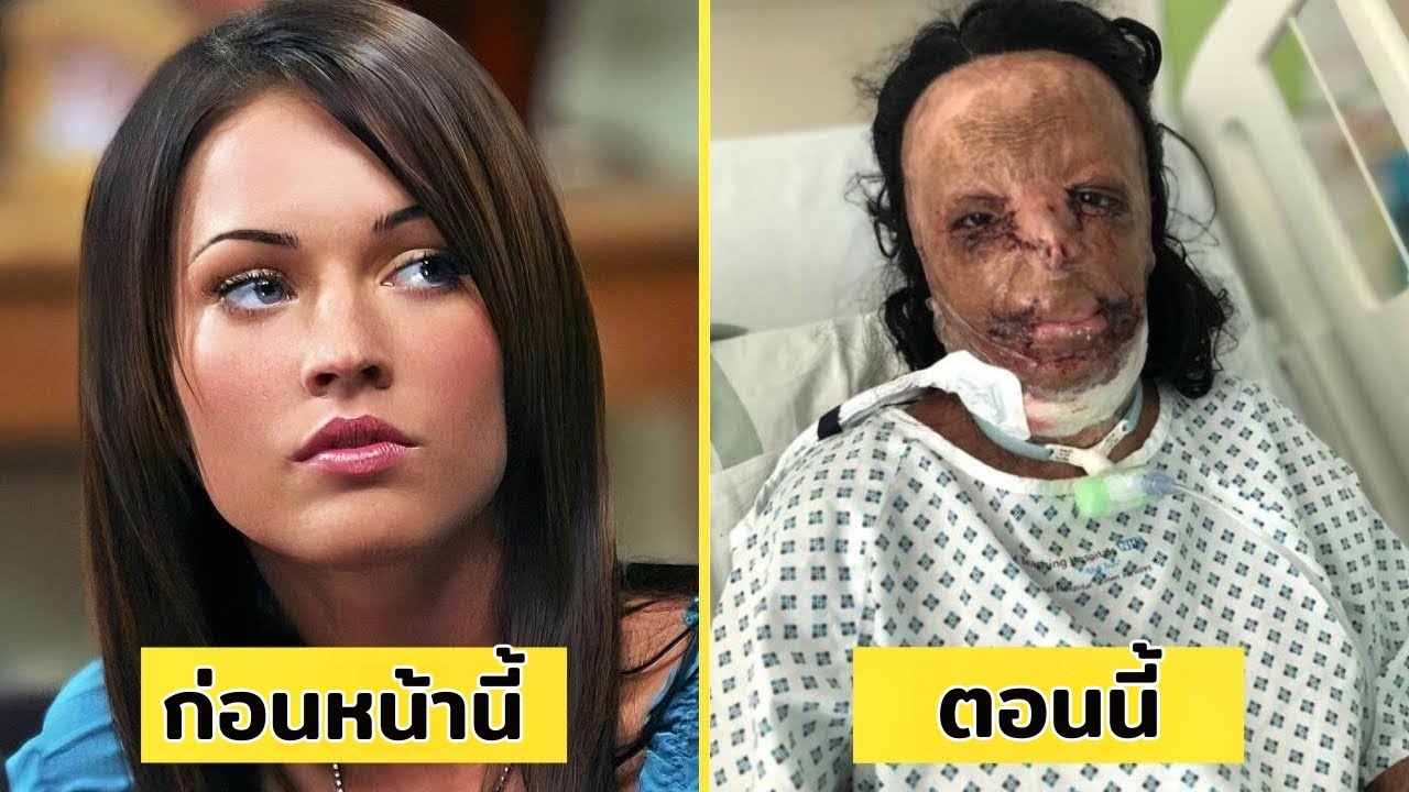 7 หายนะศัลยกรรมของคนดังที่วันนี้แทบจำไม่ได้ | Then & Now 2025