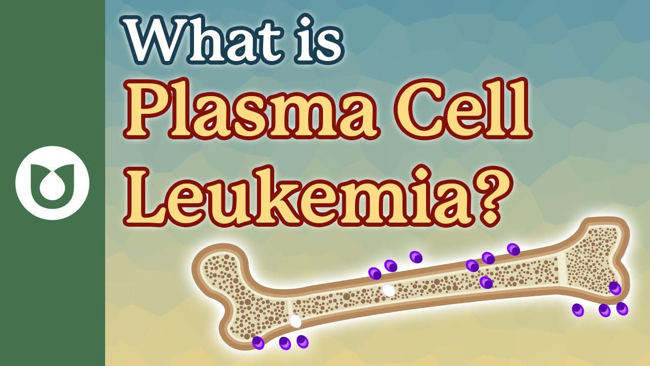 What is plasma cell leukemia? #myeloma