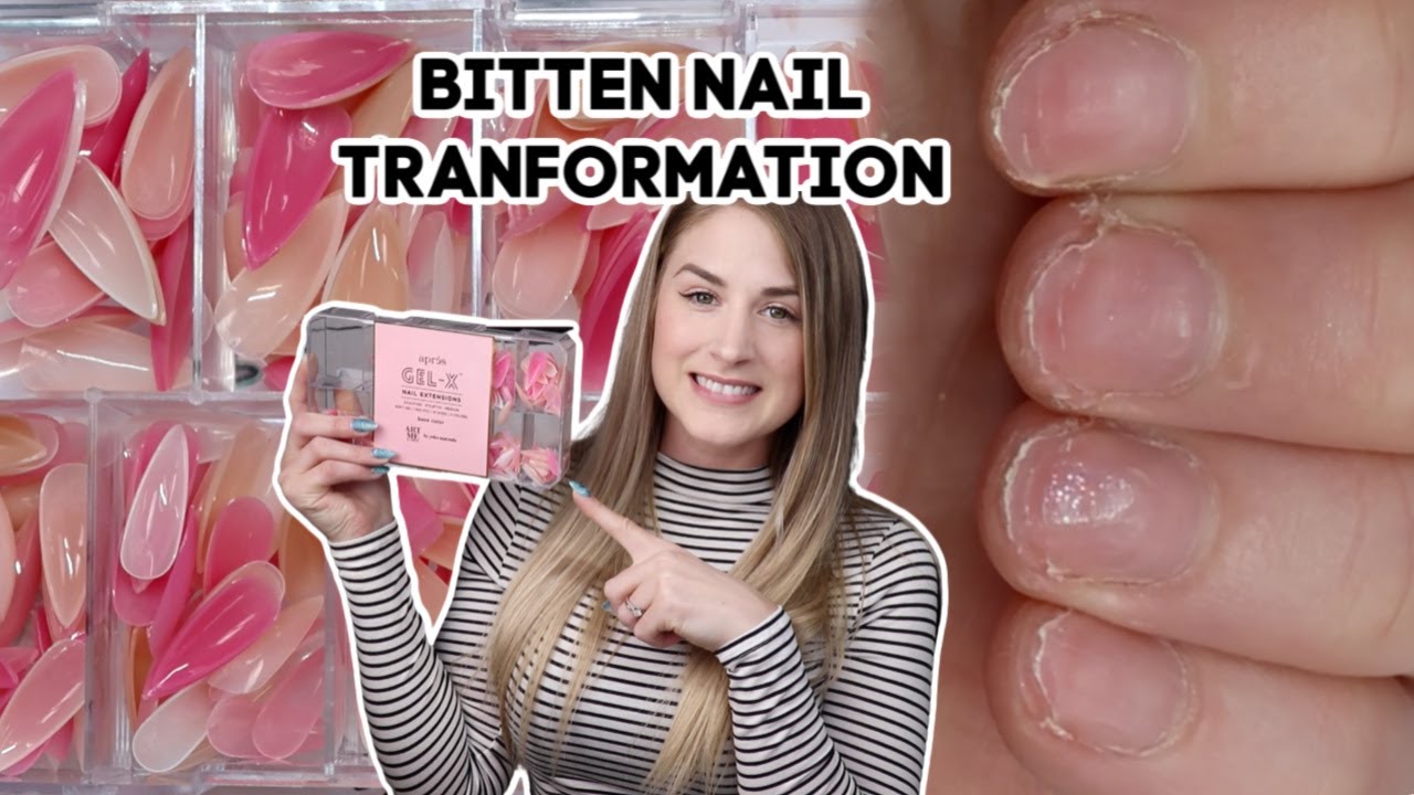 BITTEN NAIL TRANSFORMATION - DOING MY OWN NAILS