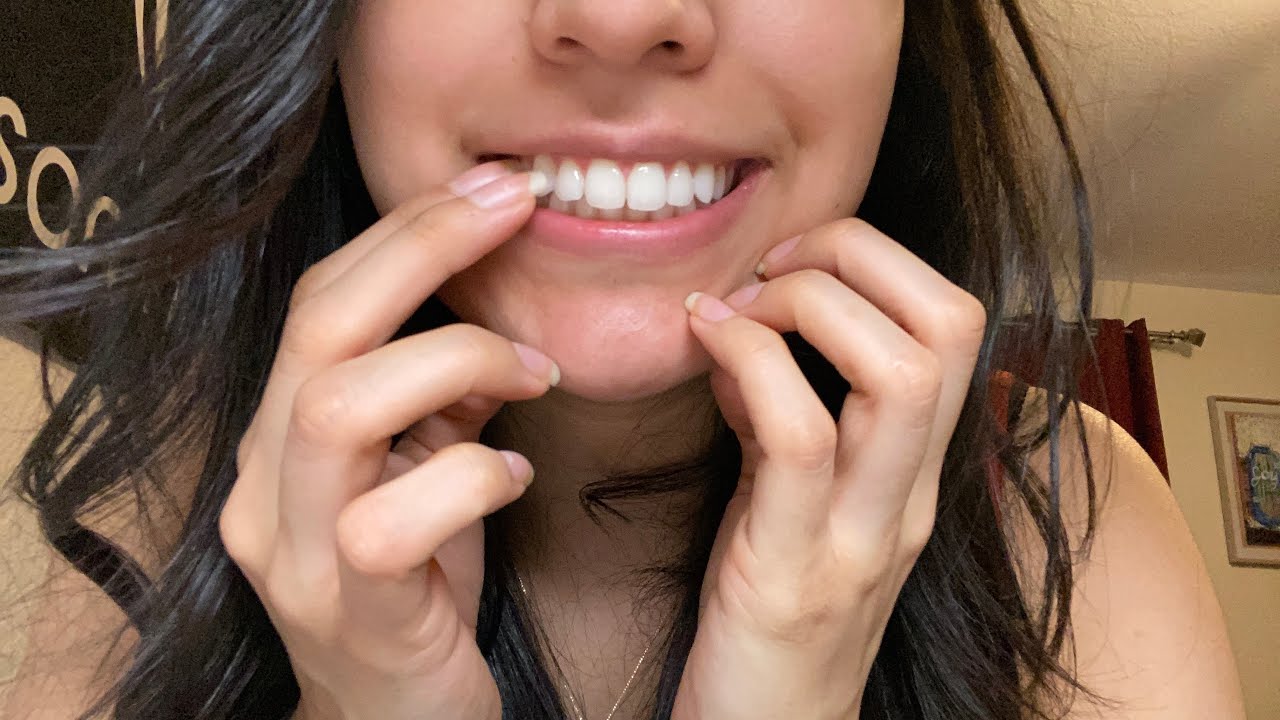 ASMR Teeth/Retainer Tapping/Scratching :D