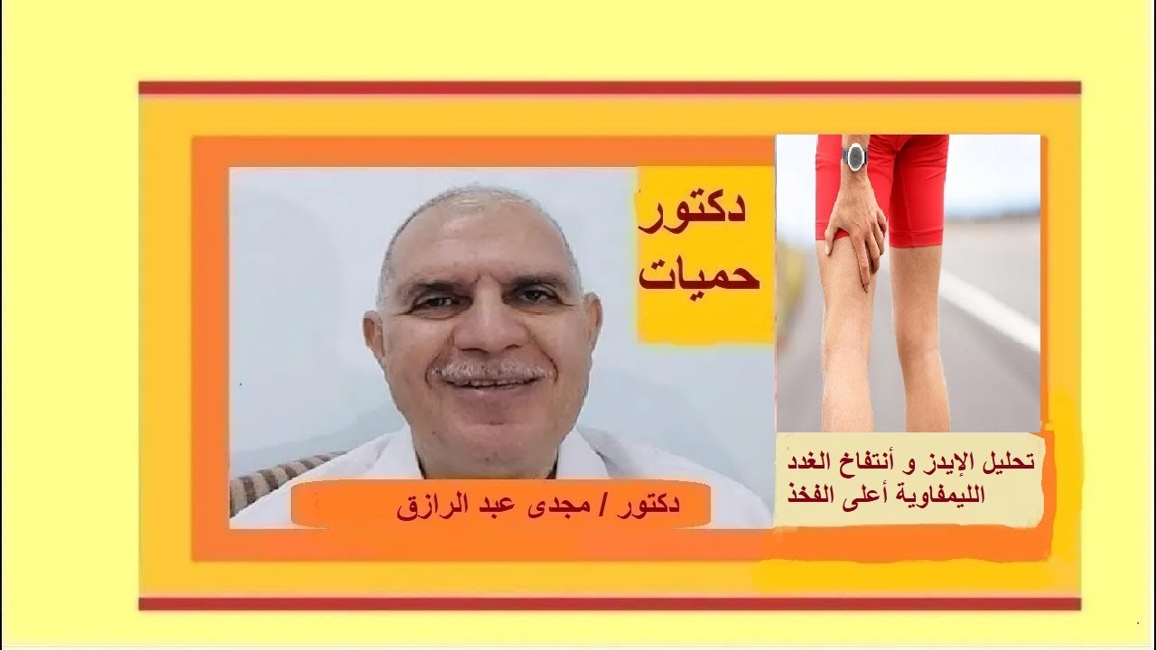 تحليل الإيدز و أنتفاخ الغدد الليمفاوية أعلى الفخذ | HIV test