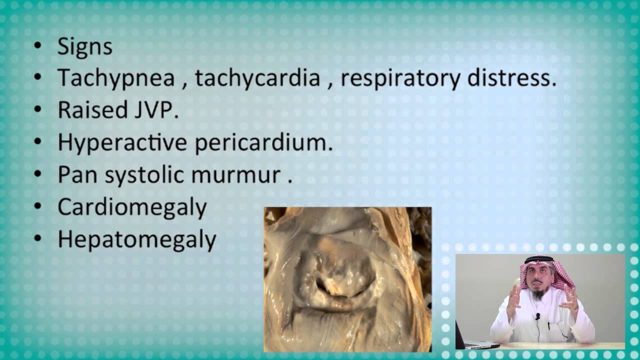 Rheumatic Fever - Dr. Zaher Faisal