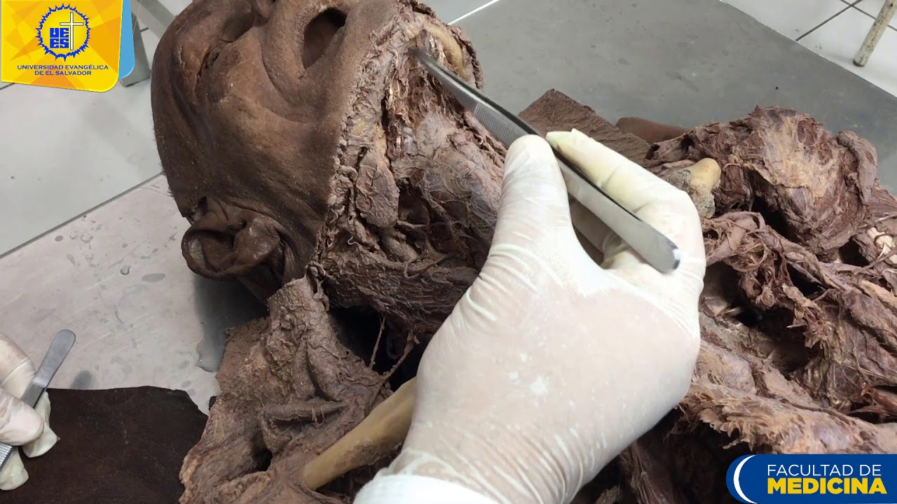 Tri&aacute;ngulos del cuello - Dr. Ernesto Hurtado