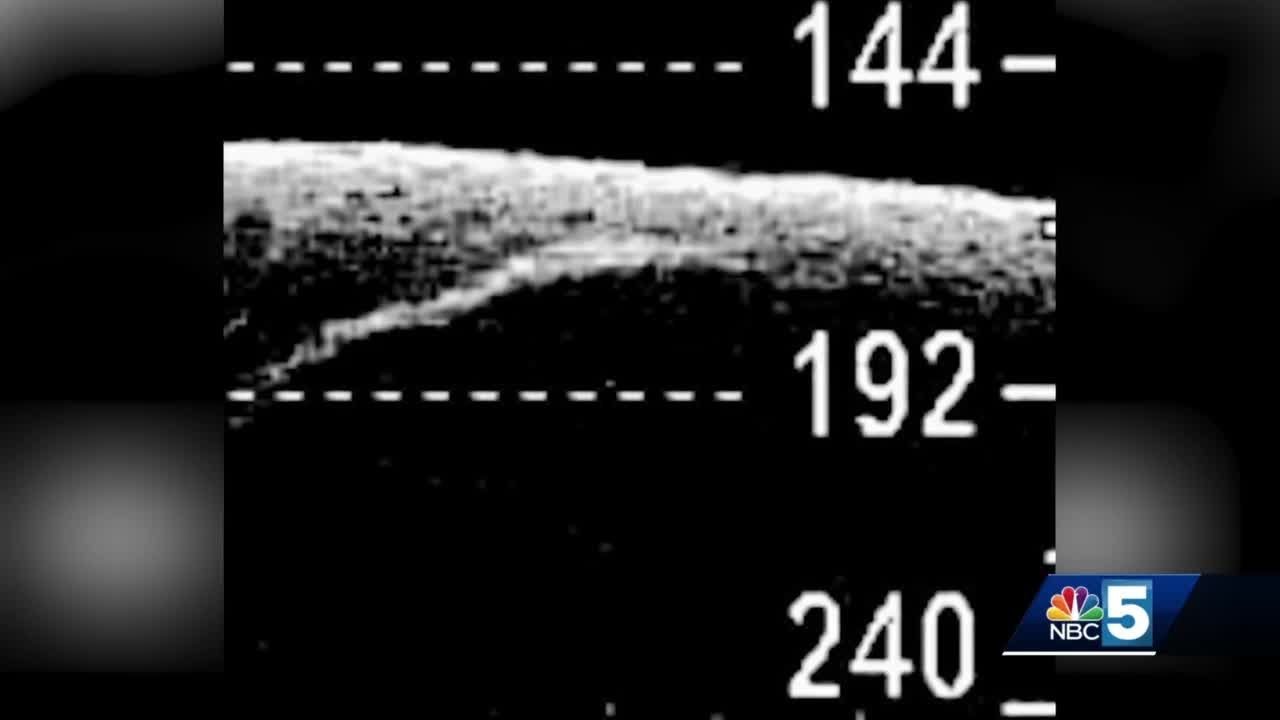 Woman believes she has sonar images of Champ