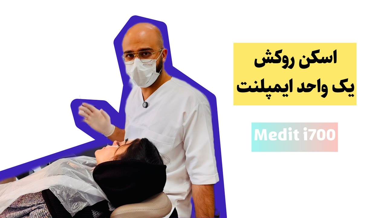 اسکن روکش یک واحد ایمپلنت با اسکنر Medit i700