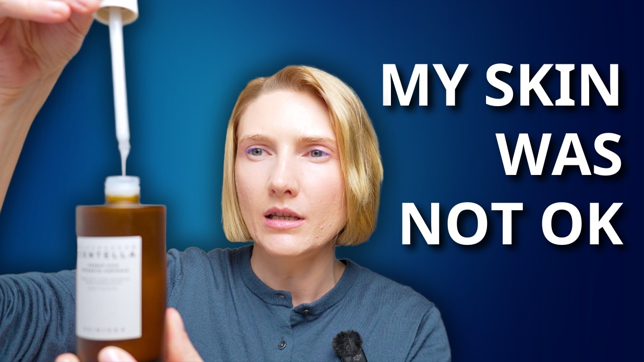 Stressed Skin: What Helped With Barrier Repair & Acne