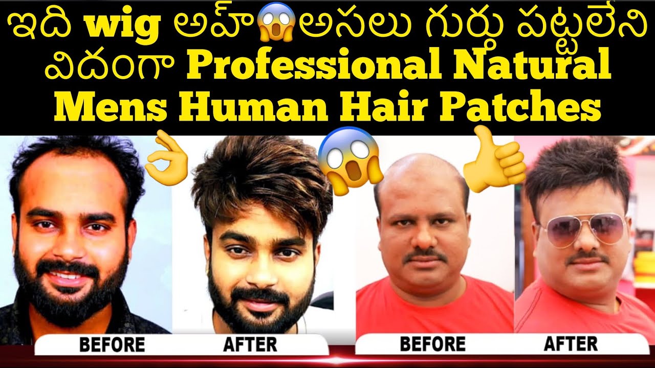 ఇది wig అహ్😱అసలు గుర్తు పట్టలేని విదంగా Professional Natural Mens Human Hair Patches, Lowest Budget