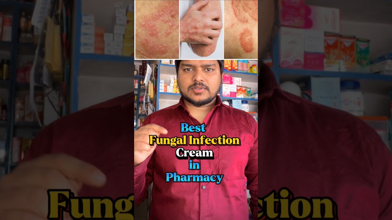 BEST FUNGAL INFECTION CREAM IN PHARMACY ll FUNGAL INFECTION IN PRIVATE PARTS #skincare