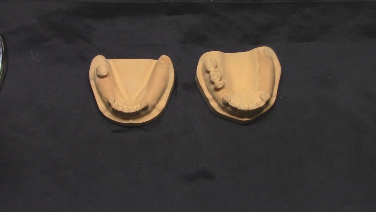 HBP Kroşe Bükümü / RPD Clasp