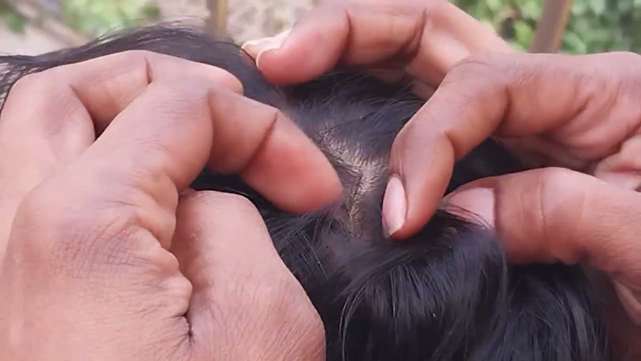 Nitpicking ASMR  video 211 #kuto #piolho #nitpicking #asmr  ( few noises in background )