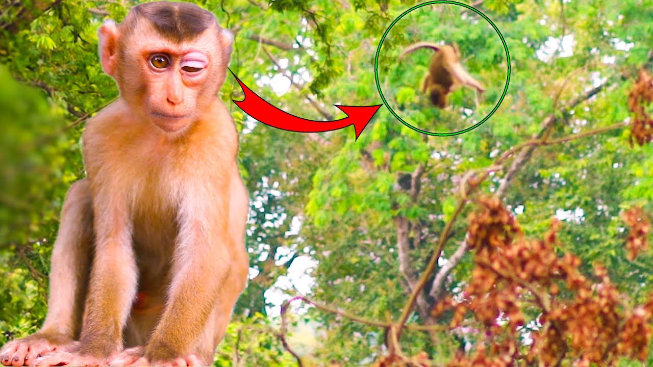 Heartbre.a.king! Sweet Baby Moken Injures His Eye After F.a.lling from a Tree