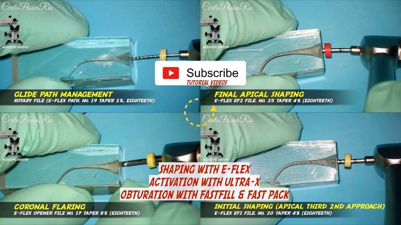 TUTORIAL ENDODONTIC SHAPING E-FLEX ROTARY FILE, ULTRA-X, FAST FILL, FAST PACK EIGHTEETH ❗️