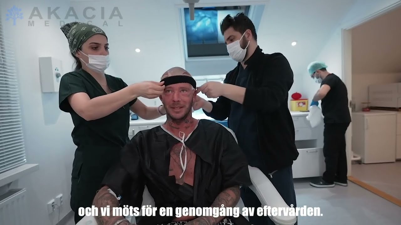 Så här går en hårtransplantation till på Akacia Medical