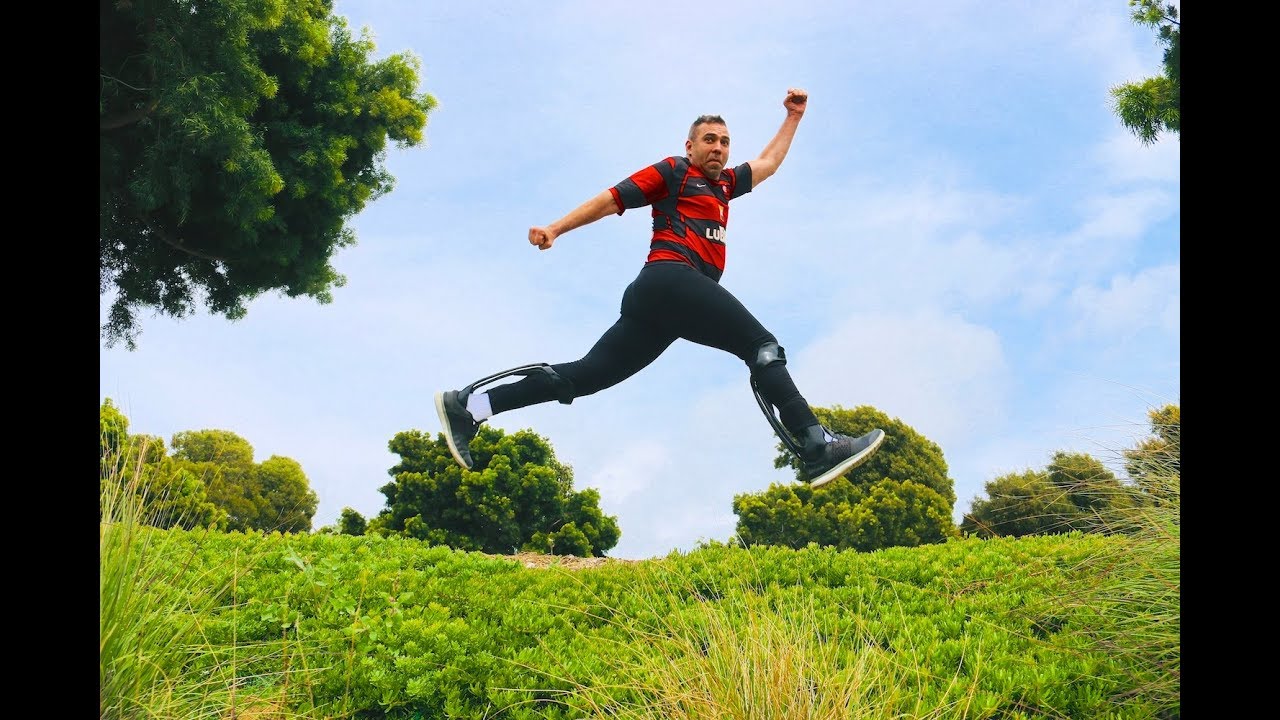 Leopold avoided CMT surgery & talks about his success with DBS braces