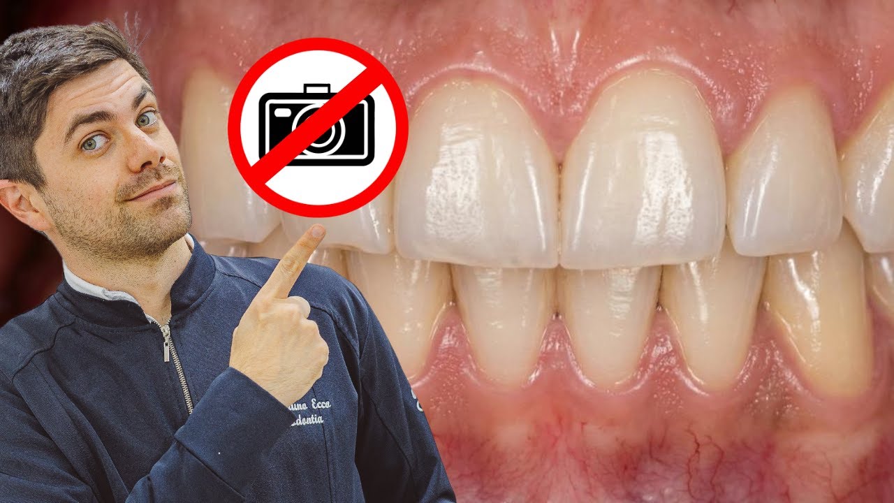 Fotos Odontológicas Profissionais Com o Celular