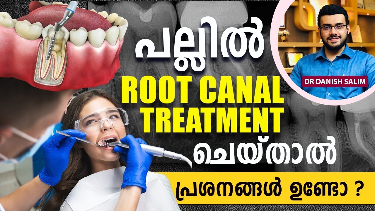 2191 : പല്ല് : റൂട്ട് കനാൽ ട്രീറ്റ്മെന്റ്  : ഭയപ്പെടേണ്ടതുണ്ടോ? അറിയേണ്ടതെല്ലാം!