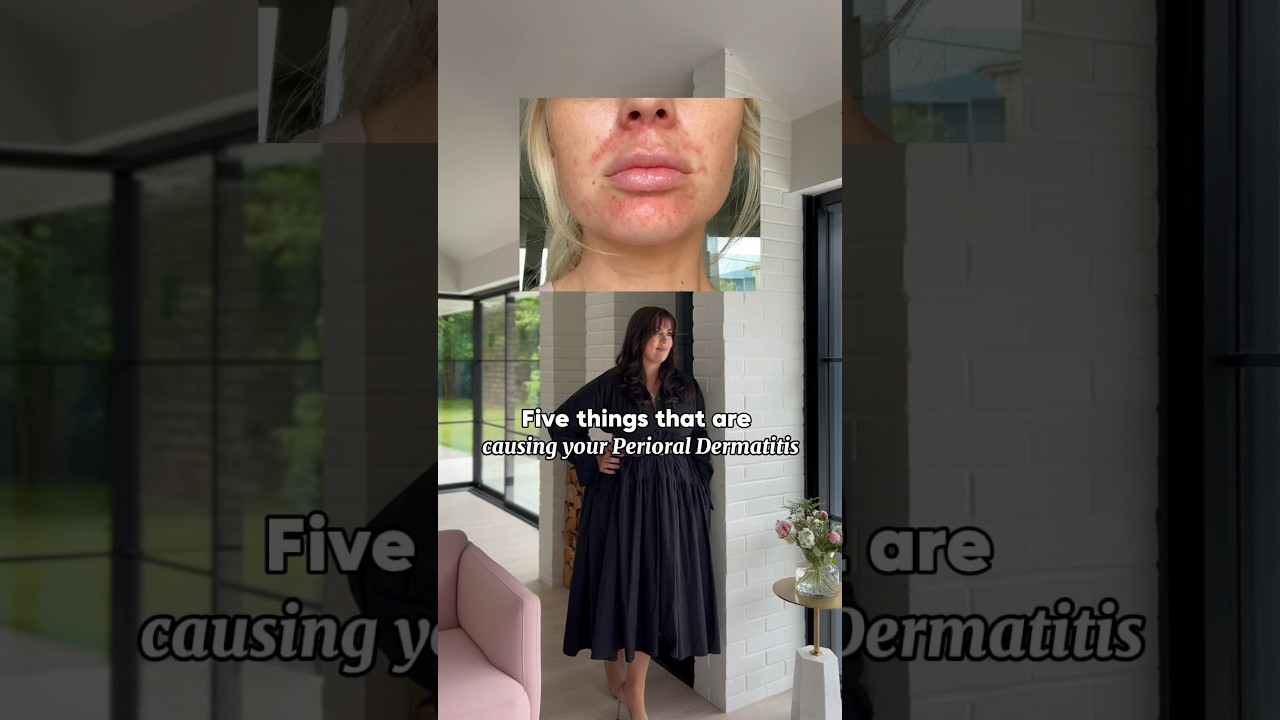 5 things that could be causing your perioral dermatitis 👆🏽 #perioraldermatitis #skincarecommunity