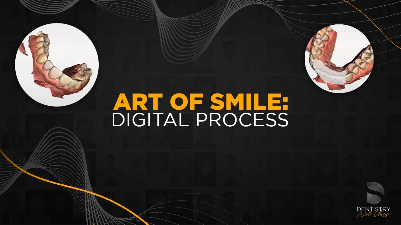 Art of Smile: Digital Process | Dentistry Web Class
