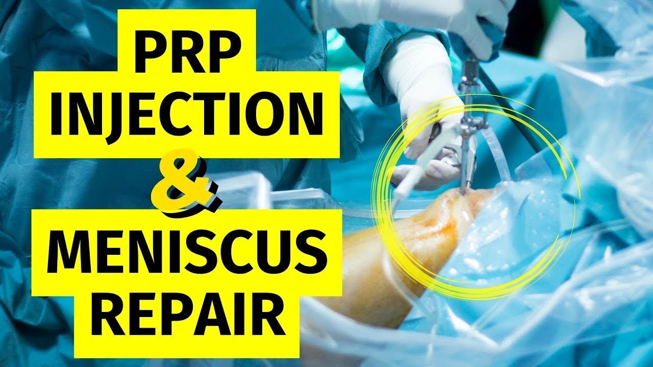 Инъекция PRP для восстановления разрыва мениска