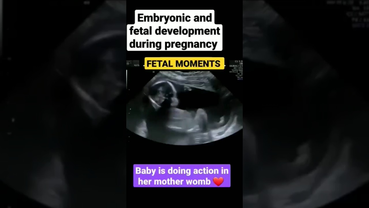 Embryonic andfetal development during pregnency#fetal moments#shiva reels#