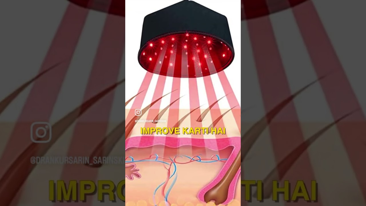 LED lights for hair Growth. | Dr. Sarin |