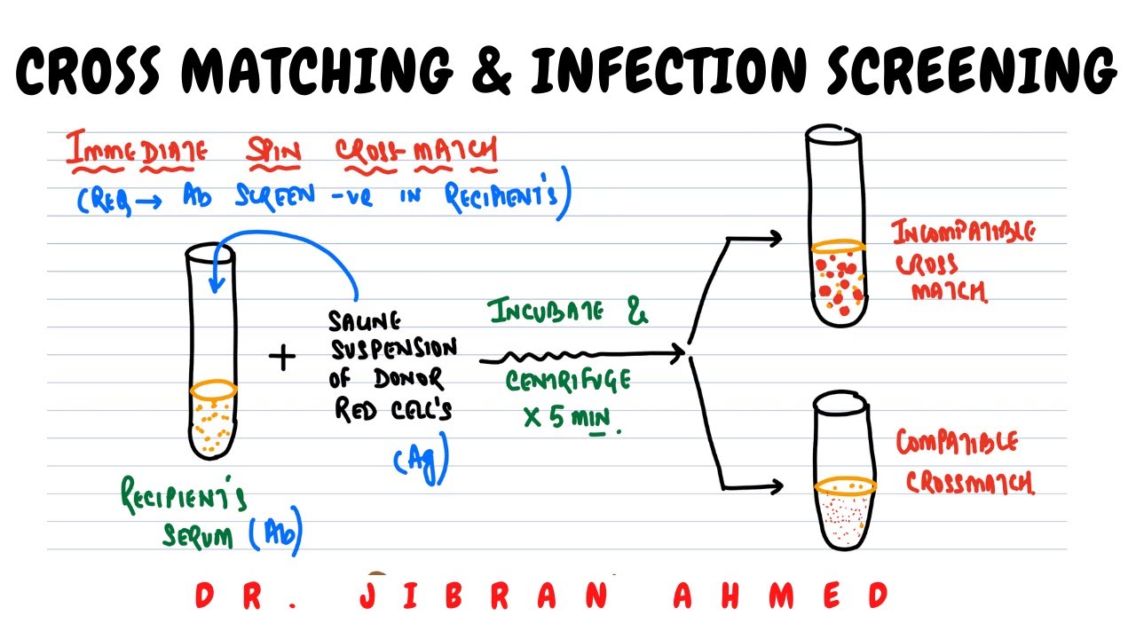 CROSS MATCHING AND SCREENING OF INFECTIONS II HEMATOLOGY II BLOOD BANKING II PATHOLOGY LECTURES II